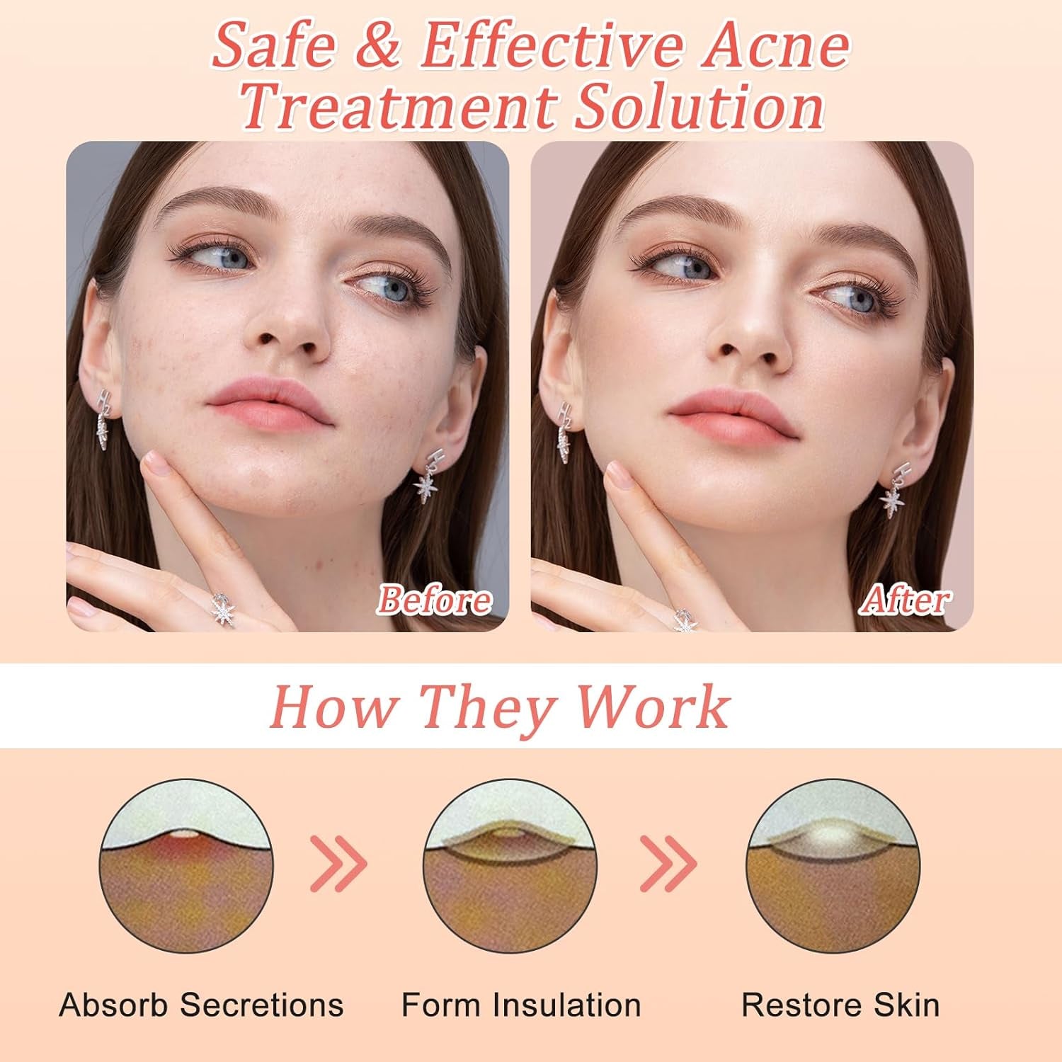 Pimple Patches for Face,144Pcs Hydrocolloid Acne Patches, Absorbing Cover Invisible Blemish Spot Patches, Spot Treatment Stickers Effectively Calm & Relieves Acne Facial Skin Care