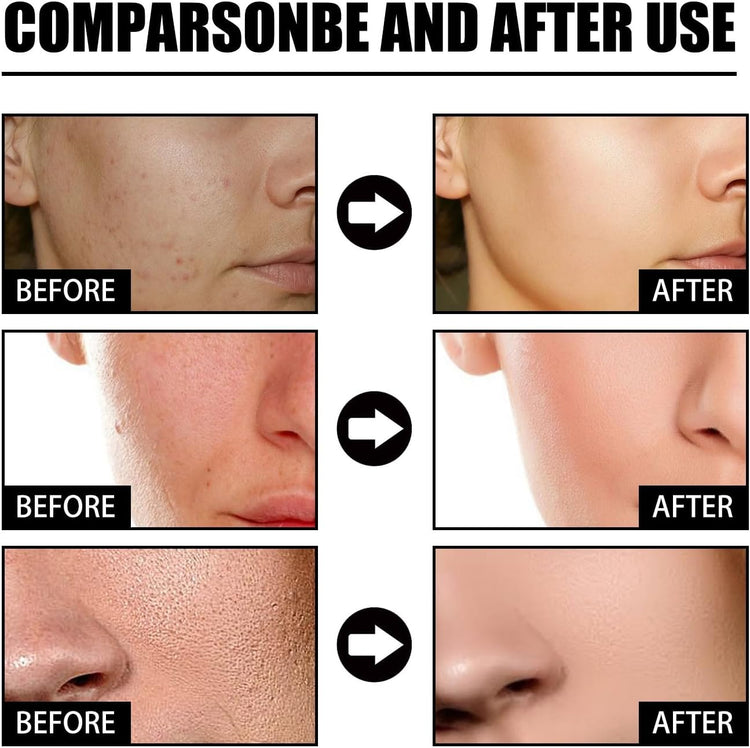 Before and after results using Saam Face Cream, Renewal Face Cream anti Wrinkle, Anti Aging Face Cream for Women.