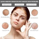 Alpha Arbutin Serum solves various skin problems, including regulating grease, shrinking pores, and repairing face serums.