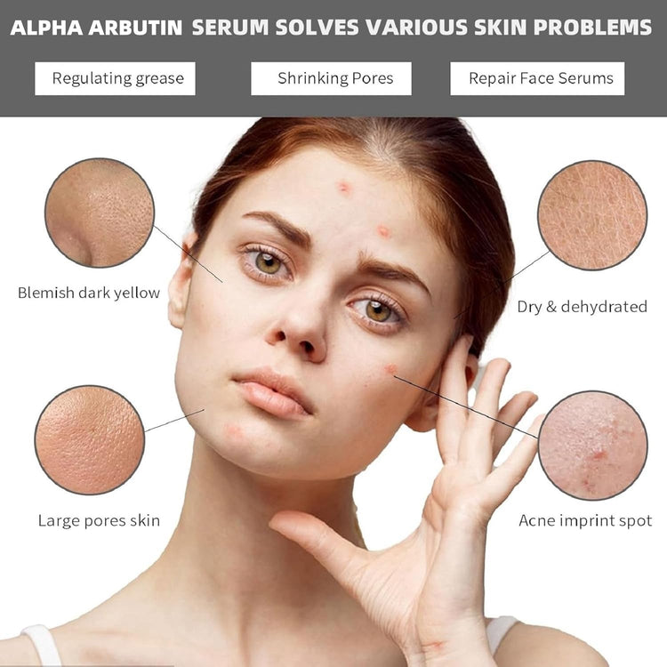 Alpha Arbutin Serum solves various skin problems, including regulating grease, shrinking pores, and repairing face serums.